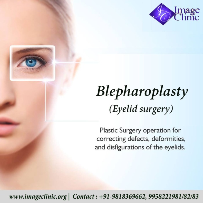 #eyelidsurgery, #blepharoplastysurgery, #cost, #uppereyelidsurgery, #eyelidsurgeryprice, #bestdoctor, #lowereyelidsurgery, #clinic, #India, #Delhi